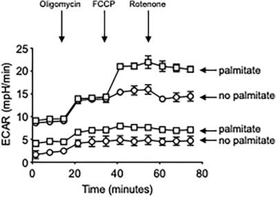 Obesity Accelerates Age-Associated Defects in Human B Cells Through a Metabolic Reprogramming Induced by the Fatty Acid Palmitate